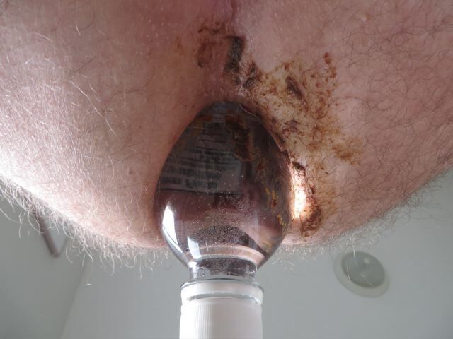 Free porn pics of Shit and plastic bottle up the butt. 4 of 8 pics