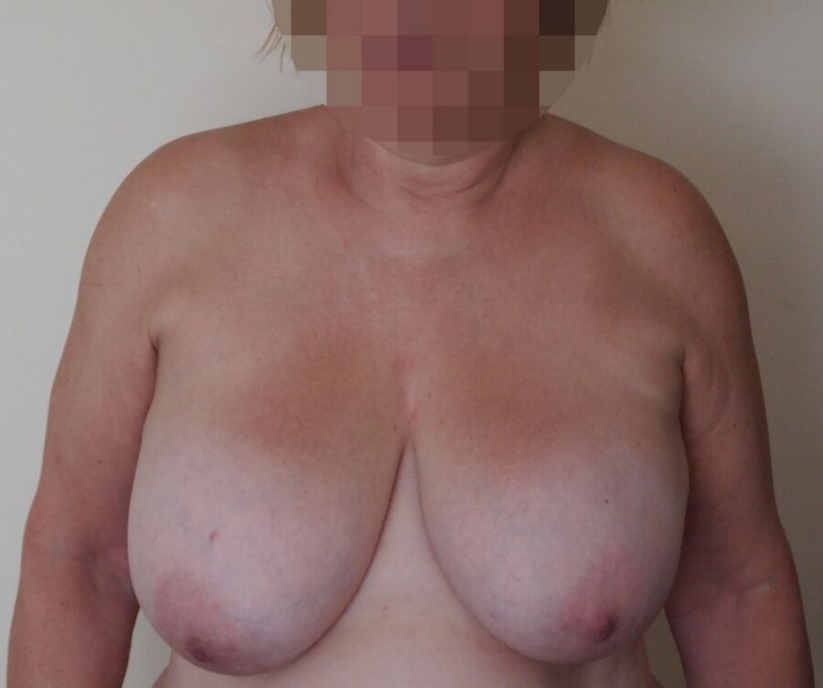 Free porn pics of Natural Heavy Granny Tits 4 of 12 pics