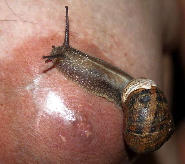 Free porn pics of Snail Skin Treatment Test... 12 of 17 pics