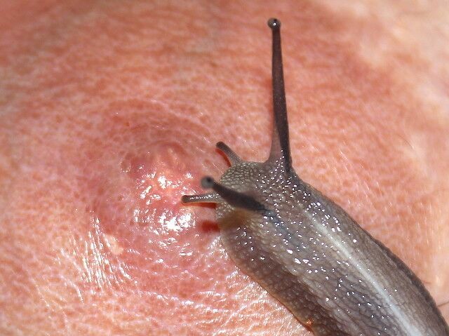 Free porn pics of Snail Skin Treatment Test... 16 of 17 pics