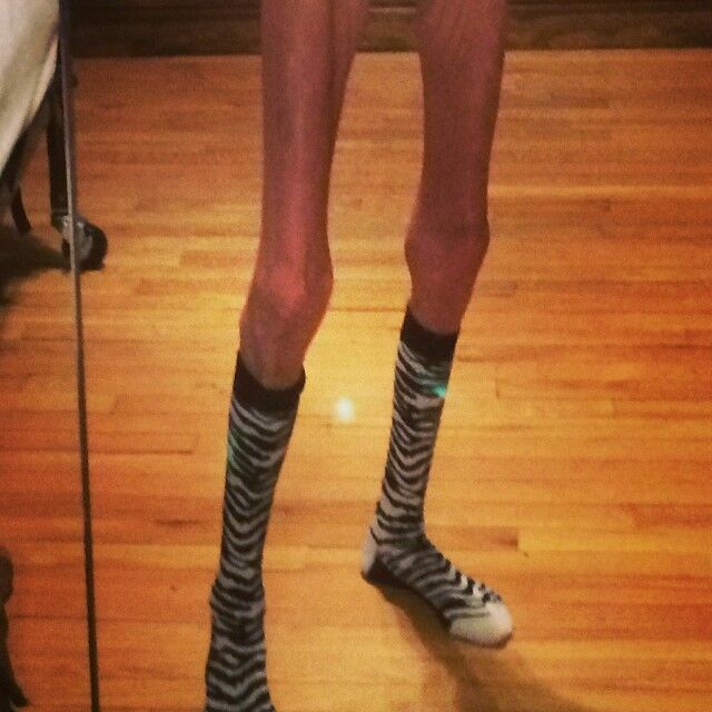 Free porn pics of Beautiful Anorexic Legs 13 of 67 pics
