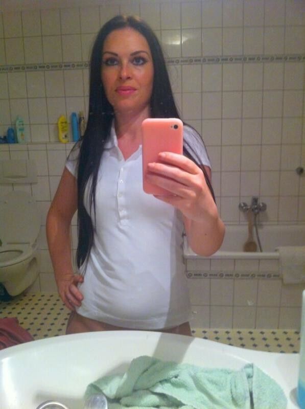 Free porn pics of German bitch fake tits before and after 18 of 28 pics