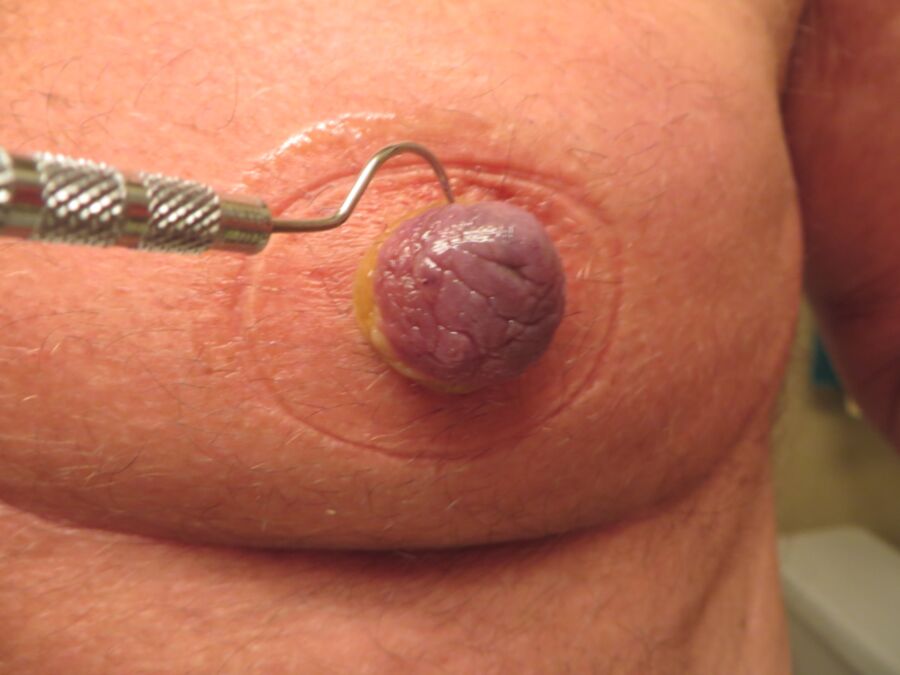 Free porn pics of sharp dental tool meets nipple 3 of 10 pics